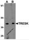 Potassium Two Pore Domain Channel Subfamily K Member 18 antibody, 5557, ProSci Inc, Western Blot image 