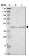 Beta-1,4-Galactosyltransferase 3 antibody, PA5-52740, Invitrogen Antibodies, Western Blot image 