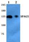 Sperm-associated antigen 5 antibody, PA5-75805, Invitrogen Antibodies, Western Blot image 
