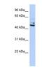 Tumor Protein P53 Inducible Protein 13 antibody, NBP1-79466, Novus Biologicals, Western Blot image 