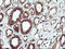 LEI antibody, LS-C174603, Lifespan Biosciences, Immunohistochemistry paraffin image 