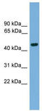 Forkhead Box A2 antibody, TA342264, Origene, Western Blot image 