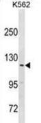 HECT And RLD Domain Containing E3 Ubiquitin Protein Ligase 3 antibody, abx031069, Abbexa, Western Blot image 