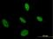 Uridine Monophosphate Synthetase antibody, H00007372-M05, Novus Biologicals, Immunofluorescence image 