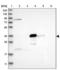 Phospholipase DDHD2 antibody, PA5-54706, Invitrogen Antibodies, Western Blot image 
