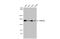 FA Complementation Group D2 antibody, GTX70299, GeneTex, Western Blot image 