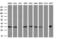 LRAT Domain Containing 2 antibody, GTX84524, GeneTex, Western Blot image 