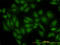 Glutaminase antibody, LS-C197311, Lifespan Biosciences, Immunofluorescence image 