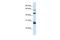 Pescadillo Ribosomal Biogenesis Factor 1 antibody, PA5-44256, Invitrogen Antibodies, Western Blot image 