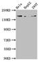 Complement C4A (Rodgers Blood Group) antibody, CSB-PA003949LA01HU, Cusabio, Western Blot image 