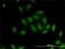 Serine/threonine-protein kinase MST4 antibody, H00051765-M01, Novus Biologicals, Immunofluorescence image 