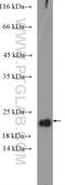 Ribonuclease P/MRP Subunit P21 antibody, 16377-1-AP, Proteintech Group, Western Blot image 