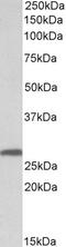 Cannabinoid Receptor 2 antibody, 45-356, ProSci, Western Blot image 
