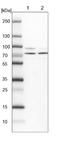 Kelch Repeat And BTB Domain Containing 8 antibody, NBP1-93570, Novus Biologicals, Western Blot image 