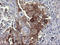 Phosphoinositide-3-Kinase Regulatory Subunit 5 antibody, LS-C174562, Lifespan Biosciences, Immunohistochemistry paraffin image 