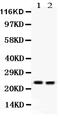 HNL antibody, PB9609, Boster Biological Technology, Western Blot image 