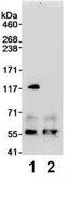 Probable ATP-dependent RNA helicase DHX36 antibody, ab70269, Abcam, Immunoprecipitation image 