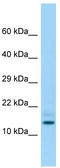 HD Domain Containing 3 antibody, TA334094, Origene, Western Blot image 