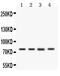 CD44 antibody, PA1021-2, Boster Biological Technology, Western Blot image 