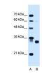 Carbonyl Reductase 1 antibody, NBP1-52872, Novus Biologicals, Western Blot image 