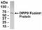Dipeptidyl Peptidase 9 antibody, XW-7778, ProSci, Western Blot image 