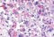 C-X-C Motif Chemokine Receptor 2 antibody, MBS240874, MyBioSource, Immunohistochemistry frozen image 