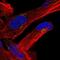 Multivesicular Body Subunit 12B antibody, NBP2-58185, Novus Biologicals, Immunofluorescence image 