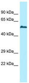 Ubiquitin Specific Peptidase 17 Like Family Member 5 antibody, TA338279, Origene, Western Blot image 
