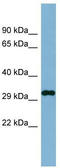 DDRGK domain-containing protein 1 antibody, TA338638, Origene, Western Blot image 