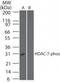Histone Deacetylase 7 antibody, NBP2-03978, Novus Biologicals, Western Blot image 