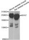 Myosin Heavy Chain 7 antibody, PA5-76225, Invitrogen Antibodies, Western Blot image 