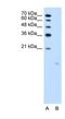 PPFIA Binding Protein 1 antibody, NBP1-56315, Novus Biologicals, Western Blot image 