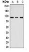 A-Kinase Anchoring Protein 3 antibody, orb235002, Biorbyt, Western Blot image 