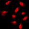 FER Tyrosine Kinase antibody, LS-C352193, Lifespan Biosciences, Immunofluorescence image 
