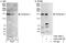 Tankyrase-1 antibody, A302-399A, Bethyl Labs, Immunoprecipitation image 