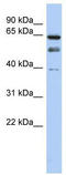 Histone acetyltransferase MYST2 antibody, TA329316, Origene, Western Blot image 
