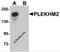 Pleckstrin Homology And RUN Domain Containing M2 antibody, 5485, ProSci Inc, Western Blot image 