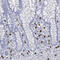Vacuolar Protein Sorting 13 Homolog D antibody, HPA051621, Atlas Antibodies, Immunohistochemistry paraffin image 