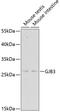 Gap Junction Protein Beta 3 antibody, GTX54127, GeneTex, Western Blot image 