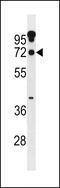 Zinc Finger Protein 805 antibody, 60-451, ProSci, Western Blot image 