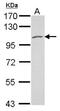 Polycystin 2, Transient Receptor Potential Cation Channel antibody, NBP2-19889, Novus Biologicals, Western Blot image 