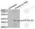 Eukaryotic Translation Initiation Factor 2 Subunit Beta antibody, AP0343, ABclonal Technology, Western Blot image 