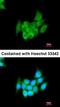 LIM Domain Kinase 2 antibody, orb14847, Biorbyt, Immunocytochemistry image 