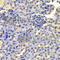 LSM4 Homolog, U6 Small Nuclear RNA And MRNA Degradation Associated antibody, A5891, ABclonal Technology, Immunohistochemistry paraffin image 