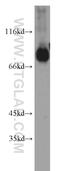 Synaptic Vesicle Glycoprotein 2B antibody, 14624-1-AP, Proteintech Group, Western Blot image 