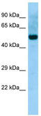 Abl interactor 2 antibody, TA343153, Origene, Western Blot image 