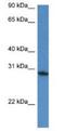 Family With Sequence Similarity 168 Member A antibody, NBP1-74067, Novus Biologicals, Western Blot image 