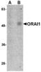 ORAI Calcium Release-Activated Calcium Modulator 1 antibody, MBS150032, MyBioSource, Western Blot image 
