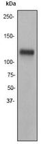 NICD antibody, TA300836, Origene, Western Blot image 