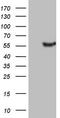 Leucine Rich Repeat Containing 6 antibody, CF806104, Origene, Western Blot image 